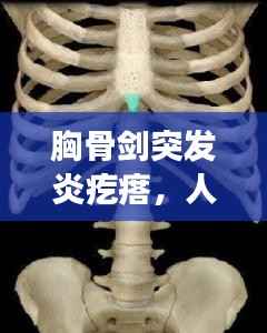 胸骨剑突发炎疙瘩,人体胸骨剑突长了一个球样东西